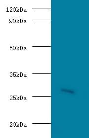 GAMT Antibody