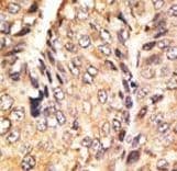 GDF10 / BMP3B Antibody (aa33-62)