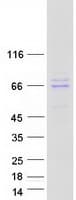 Human GRK4 Protein (Recombinant Myc-DDK (Flag))