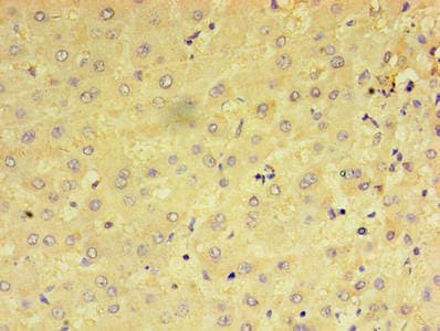 PRAME Antibody (aa1-509)