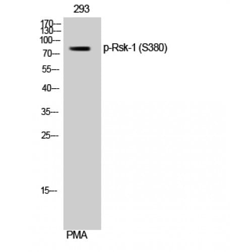 RPS6KA1 / RSK1 Antibody (320-400 aa)