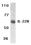 Polyclonal Rabbit anti-Human IL22RA1 / IL22R Antibody (WB)