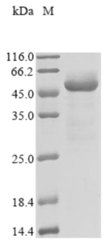 Coronavirus SARS-CoV-2 Nucleoprotein (Recombinant His,N-terminus)
