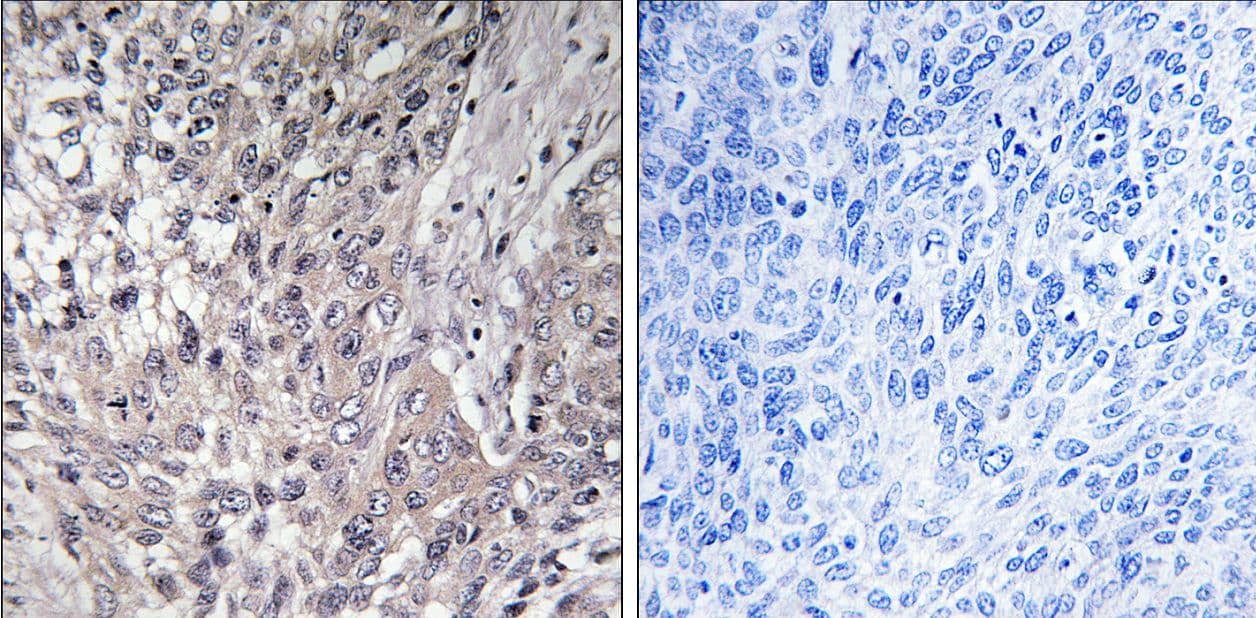 VASP Antibody (phospho-Ser157)