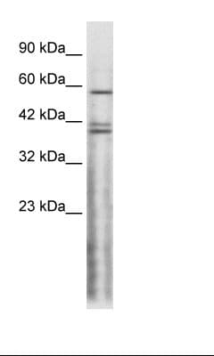 CHRND Antibody (N-Terminus, FITC)