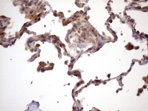 Vps60 / CHMP5 Antibody (clone OTI5C7)