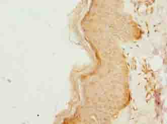 Polyclonal Rabbit anti-Human CCDC89 Antibody (IHC, WB)
