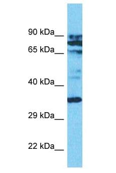 ASMT / HIOMT Antibody (aa53-102)