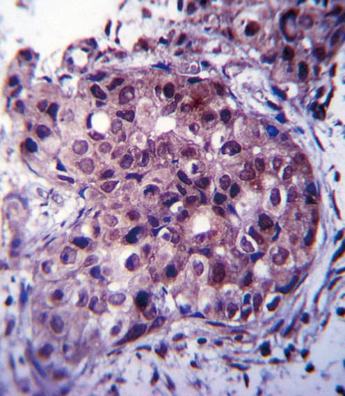 ER Alpha / Estrogen Receptor Antibody (aa246-273)