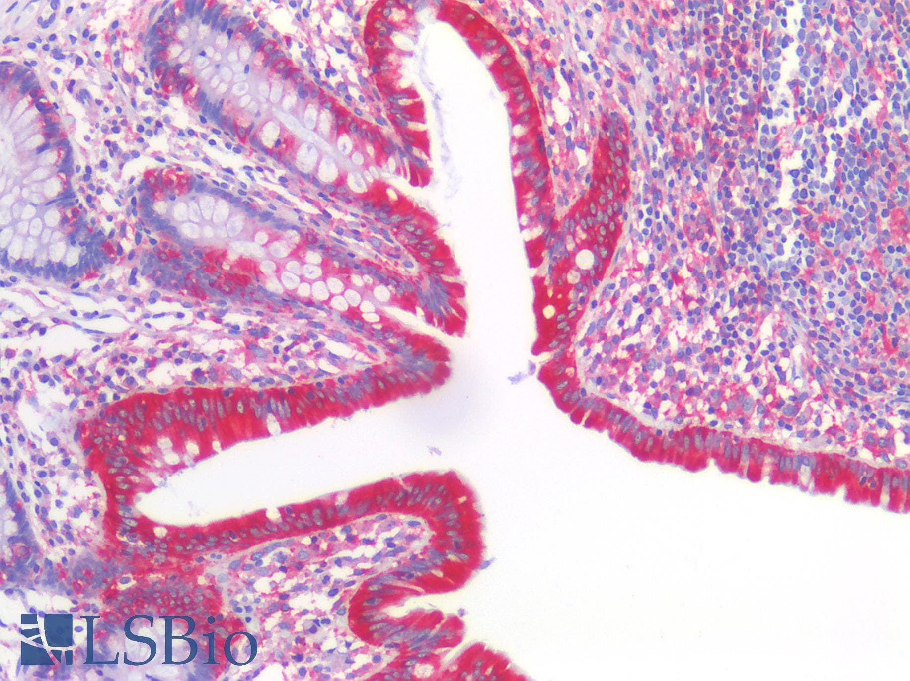 PathPlus™ MVP / VAULT1 Antibody (clone 2H3-1A6)