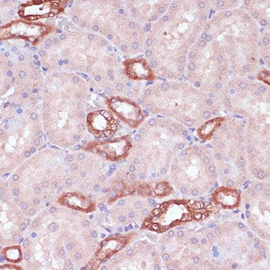 Polyclonal Rabbit anti-Human UGT2B15 Antibody (IHC)