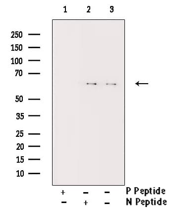Polyclonal Rabbit anti-Human CHEK2 / CHK2 Antibody (phospho-Thr383, IHC, IF, WB)