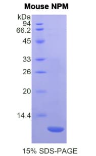 Mouse NPM1 / NPM / Nucleophosmin Protein (Recombinant His)