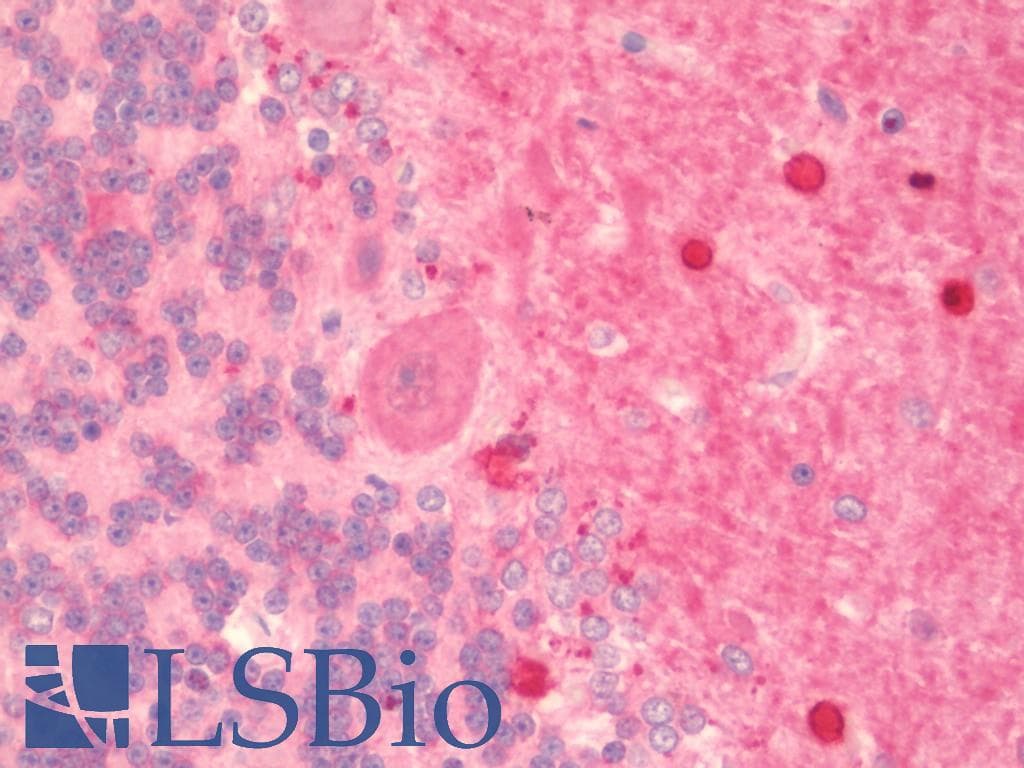 IHC-plus™ ANK2 / Ankyrin B Antibody (aa203-496, clone S105-17)