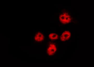 Polyclonal Rabbit anti-Human FOXO1 / FKHR Antibody (phospho-Ser256, IHC, IF, WB)