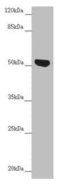 CDCA1 / NUF2 Antibody