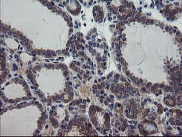 VBP1 Antibody (clone OTI1A5)