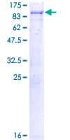 Human SRPK3 / MSSK1 Protein (Recombinant GST)