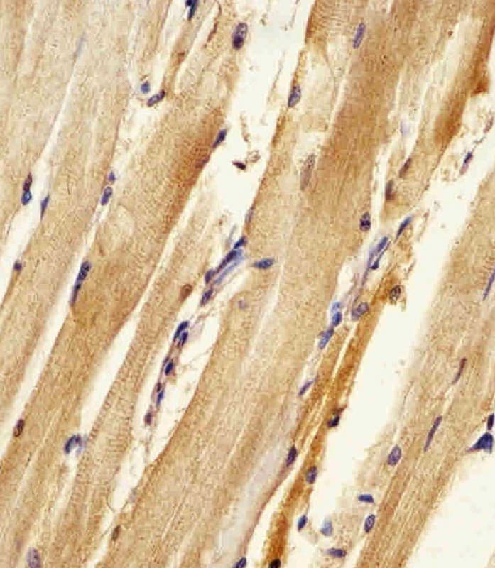 AK2 / Adenylate Kinase 2 Antibody (aa3-39)