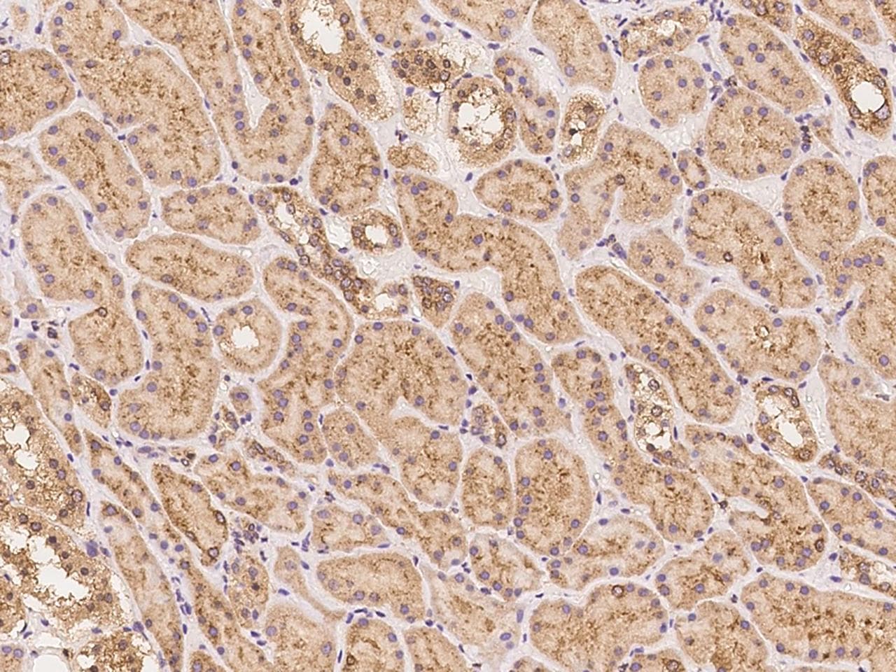 COPG / Gamma-COP Antibody