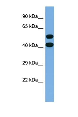 Polyclonal Rabbit anti-Human Spastin Antibody (aa361-410, WB)
