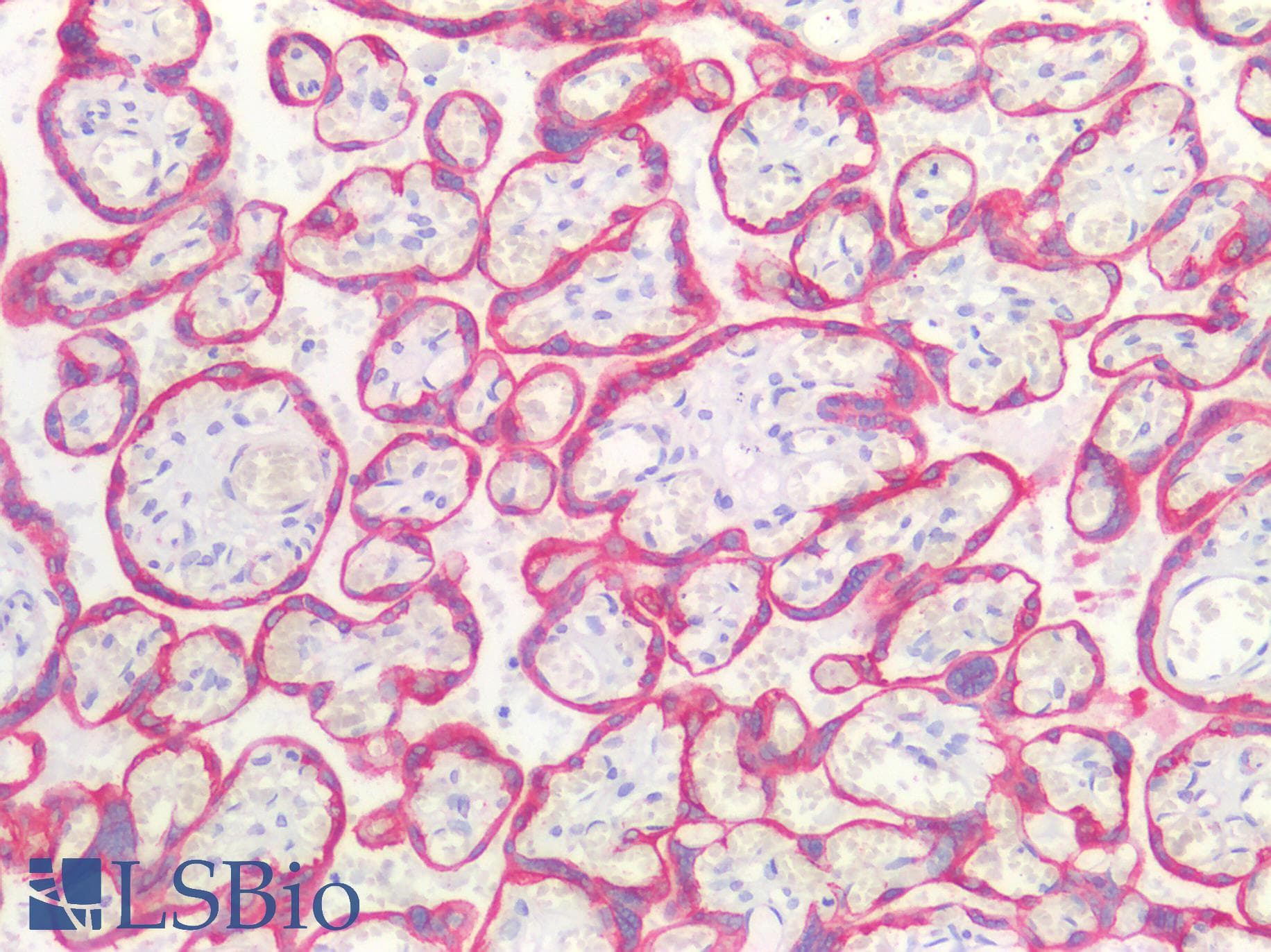 PathPlus™ Monoclonal Mouse anti-Human Cytokeratin AE1+AE3 Antibody (clone AE1+AE3, IHC)