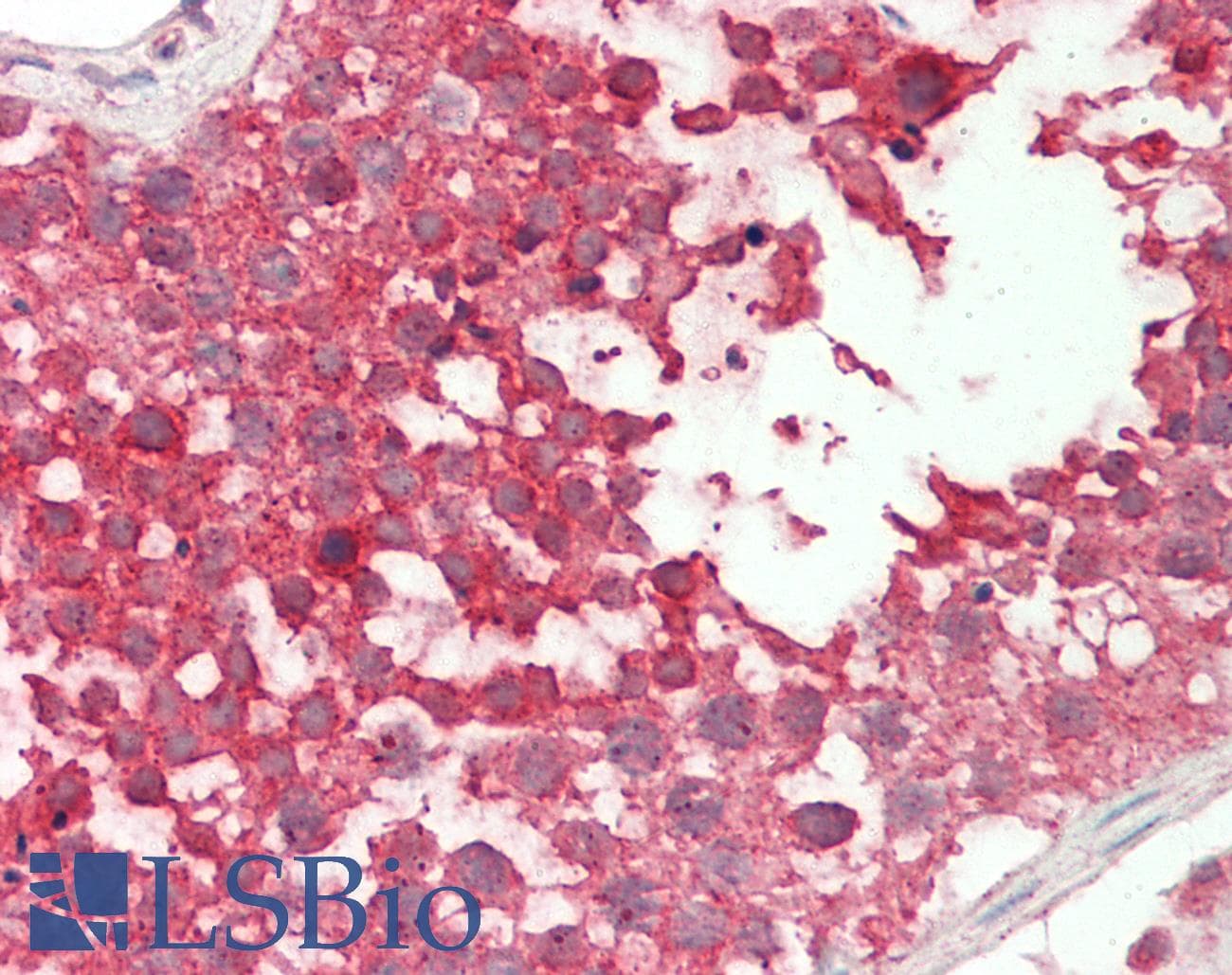 PTPRR Antibody (aa282-331)