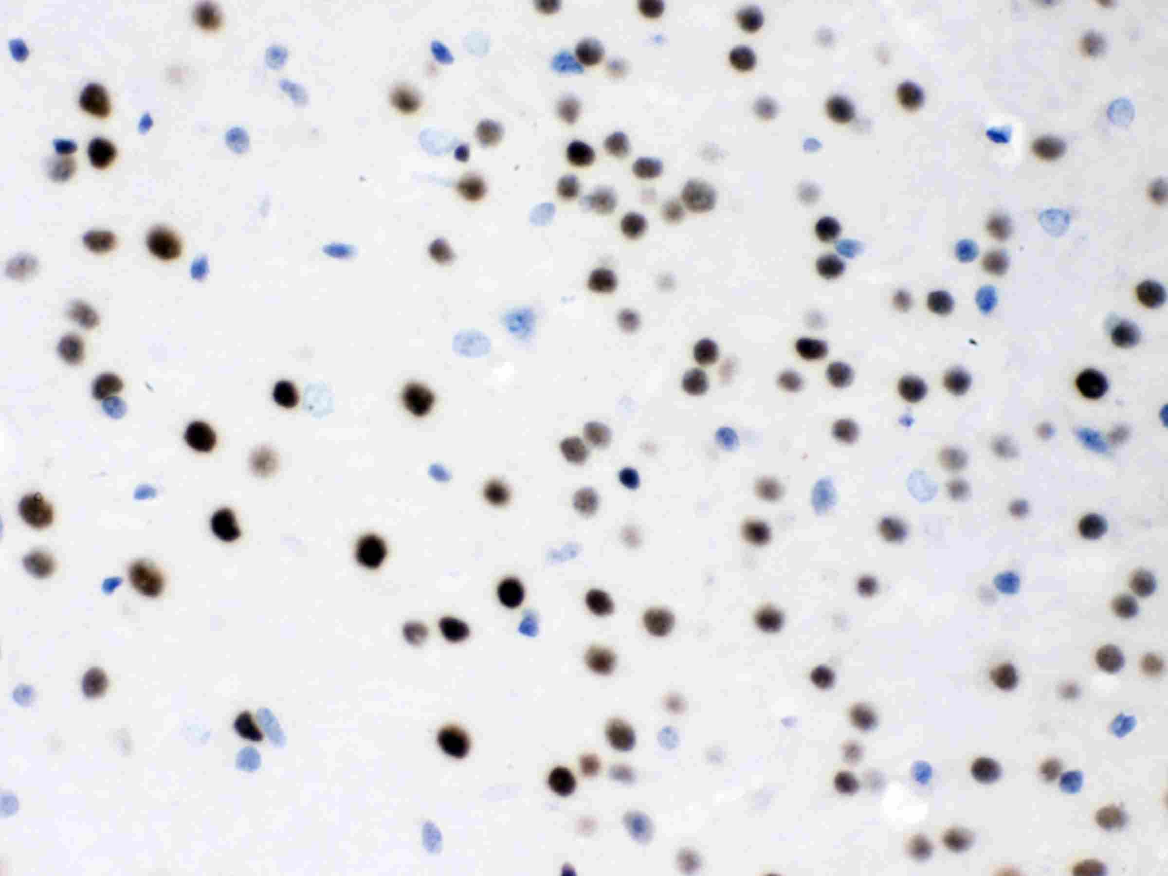 MEF2A / MEF2 Antibody