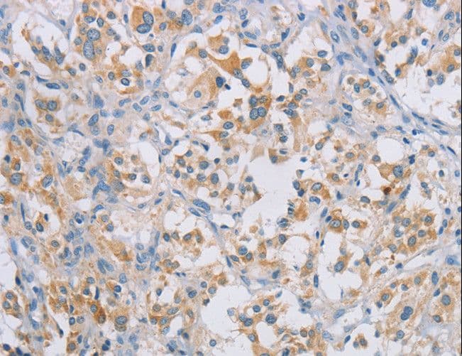 CERKL Antibody