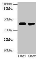 CKB / Creatine Kinase BB Antibody (aa2-270)