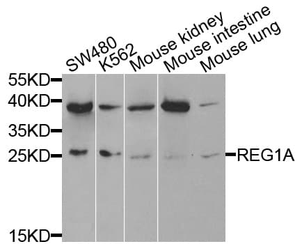 REG1A Antibody