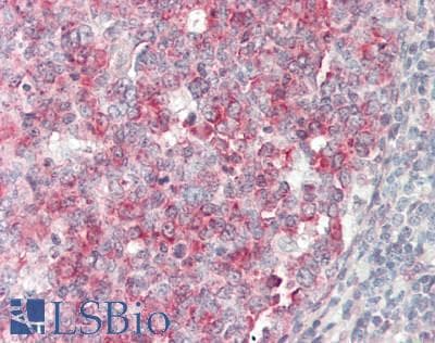 IHC-plus™ METAP2 Antibody (aa100-150)