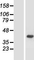 ACMSD Protein (Over-Expression Lysate Myc-DDK (Flag))