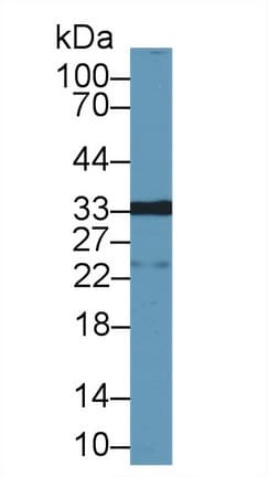 LGALS12 / Galectin 12 Antibody (aa1-314, APC)