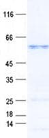 Human CCDC105 Protein (Recombinant His, N-Terminal)