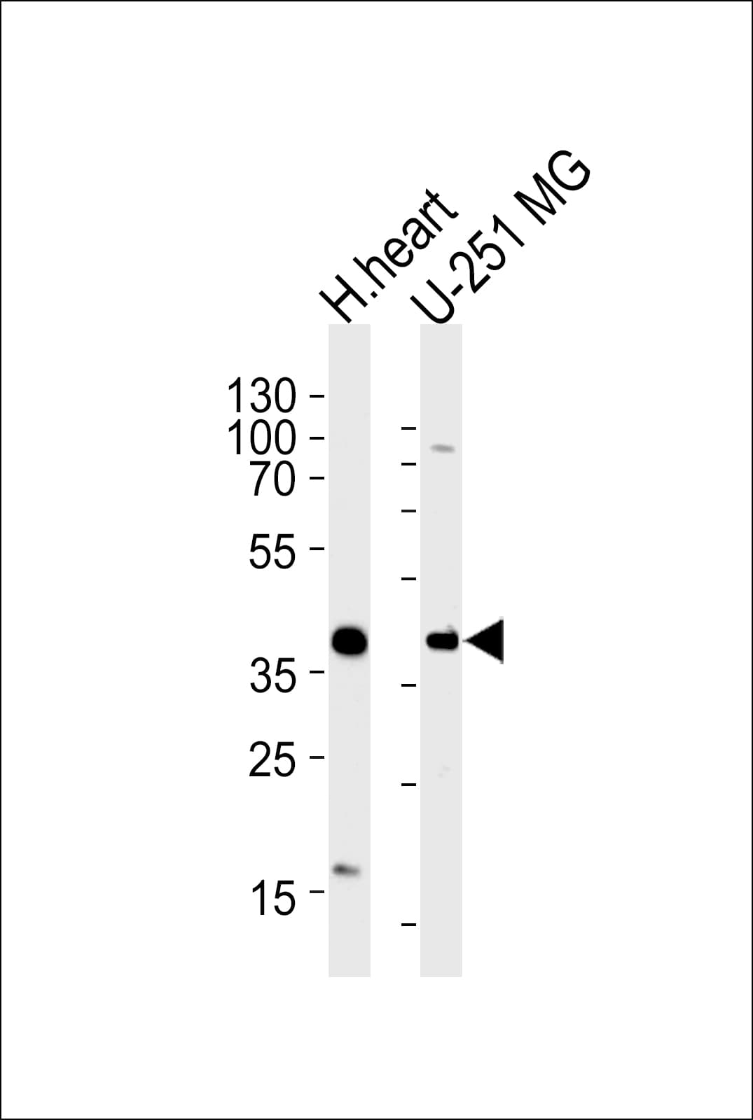 AKTIP / FTS Antibody (aa262-288)