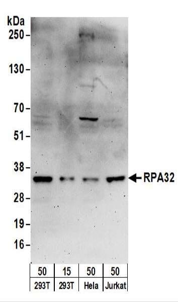 IHC-plus™ RPA2 / RFA2 / RPA34 Antibody (aa220-270)