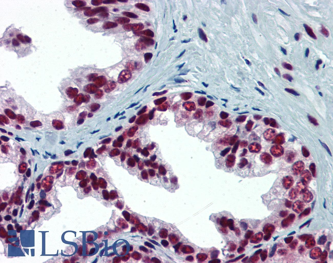 IHC-plus™ SP1 Antibody (clone 1A5)