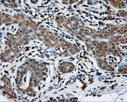Monoclonal Mouse anti-Human NPR3 Antibody (clone OTI11B6, IHC, IF, WB)
