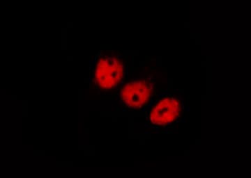NFKBIA / IKB Alpha / IKBA Antibody (phospho-Tyr305)
