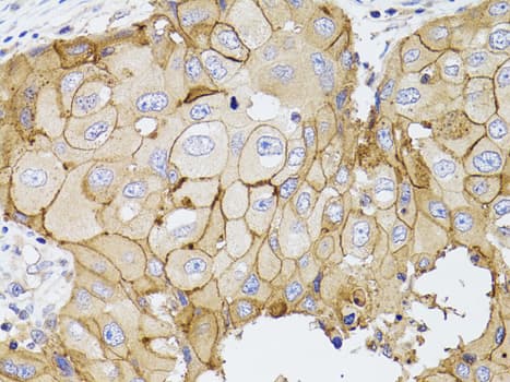 Polyclonal Rabbit anti-Human PDE4D Antibody (IHC, WB)