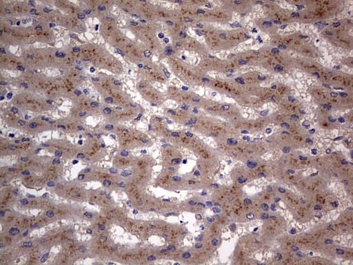 Monoclonal Mouse anti-Human SMPD1 / Acid Sphingomyelinase Antibody (clone OTI3H7, aa62-341, IHC, WB)