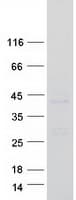 Human TMEM59 Protein (Recombinant Myc-DDK (Flag))