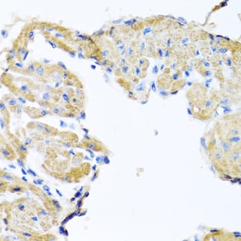 GPLD1 / GPIPLD Antibody