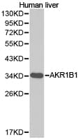 AKR1B1 / Aldose Reductase Antibody