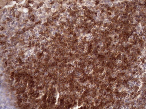 CD22 Antibody (aa707-847, clone OTI1E6, Carrier-free)