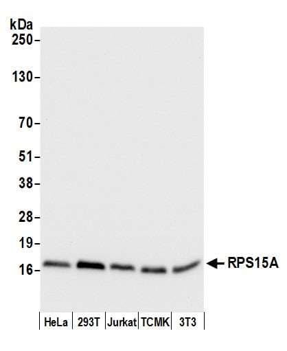 RPS15A Antibody (aa1-50)