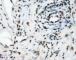 SORD / Sorbitol Dehydrogenase Antibody (clone OTI15H2)