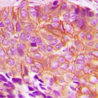 BIK Antibody (phospho-Thr33)