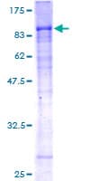Human WDR20 Protein (Recombinant GST)
